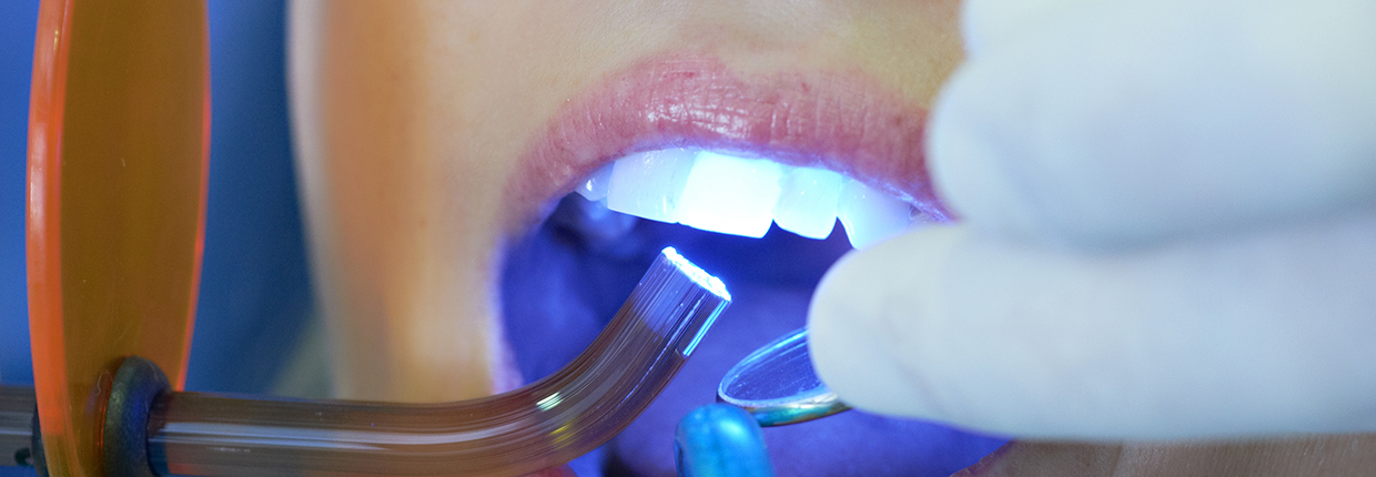Dental Esthetics